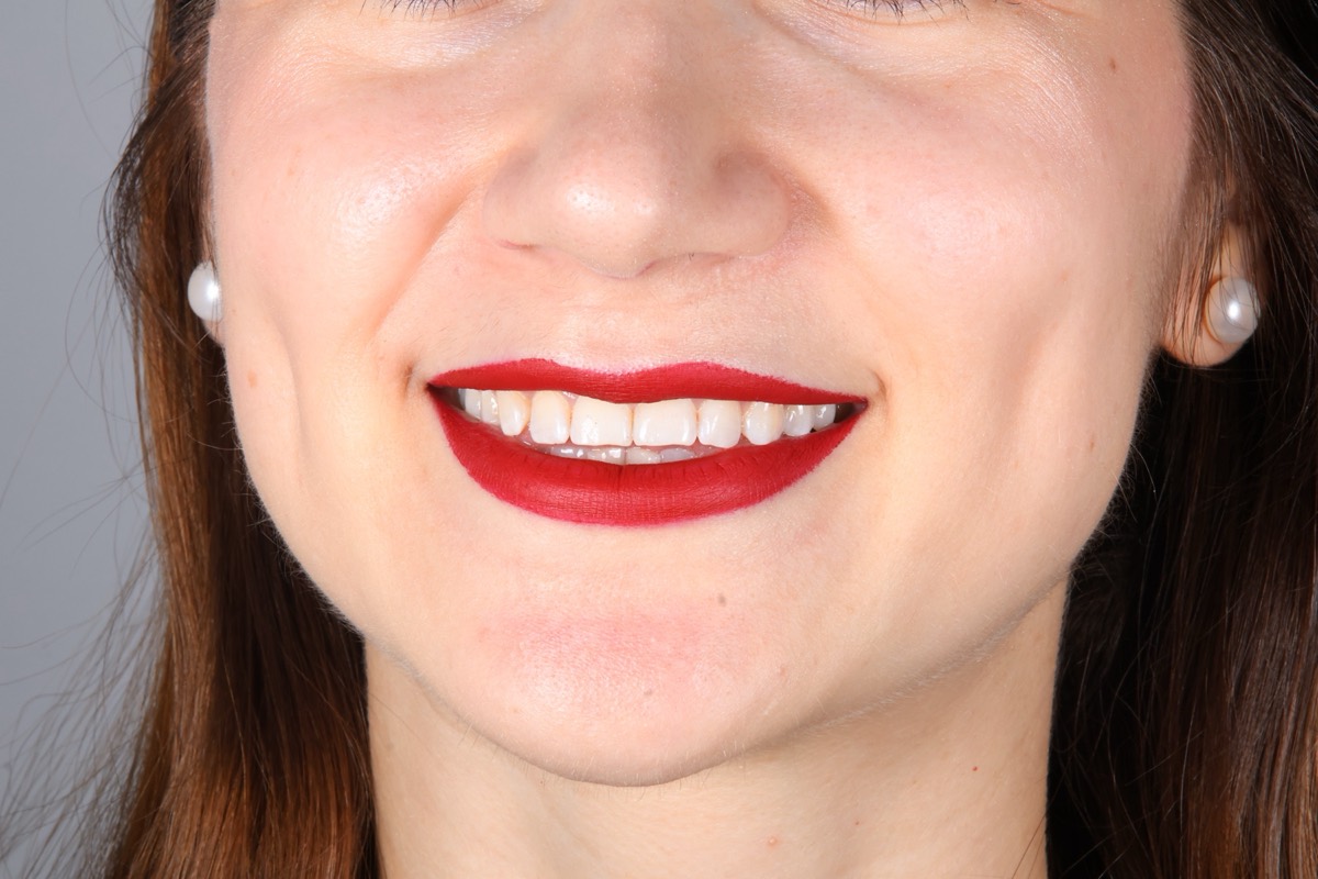 Smile Case 1 image 10