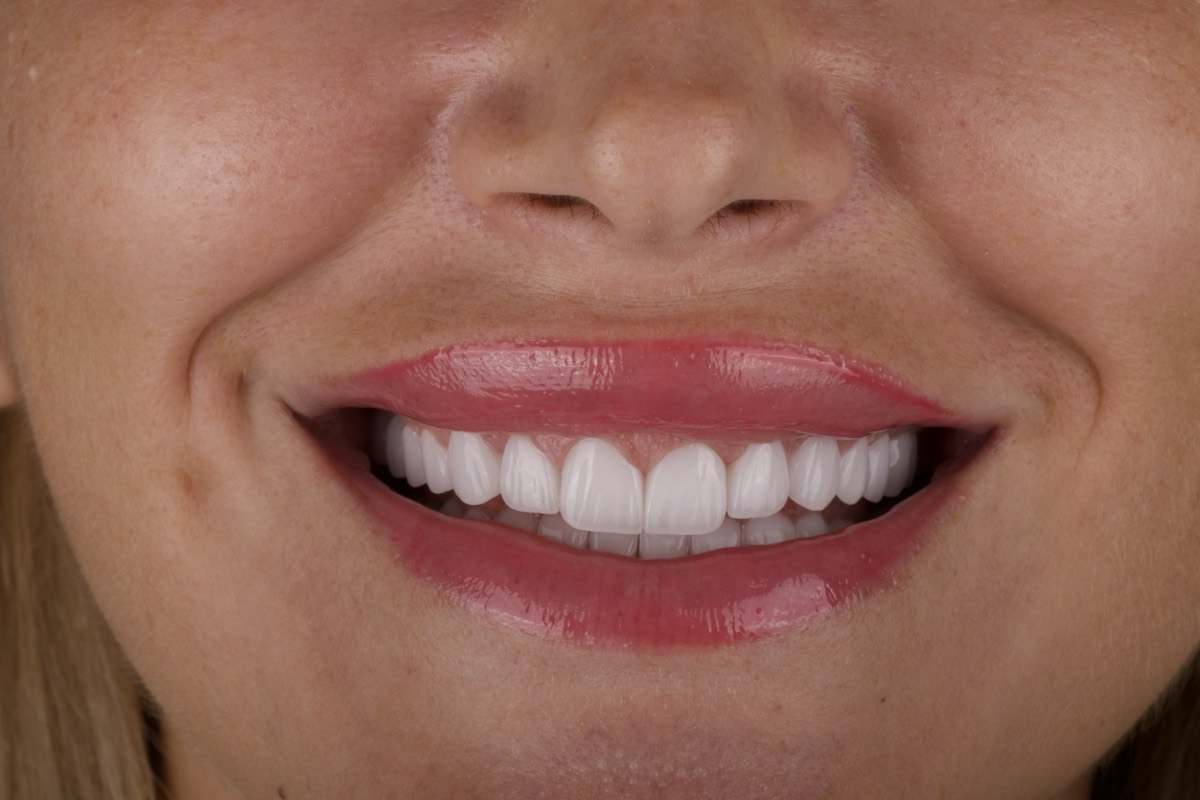 Smile Case 10 cover