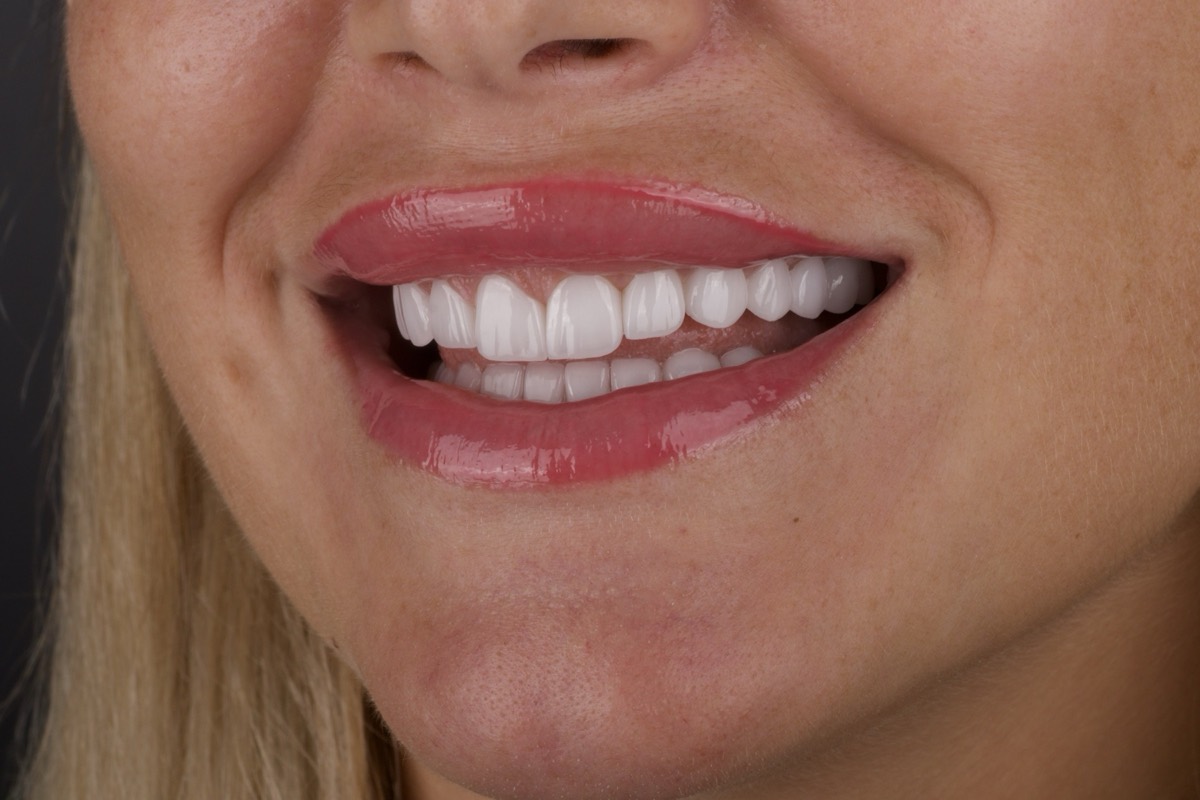 Smile Case 10 image 3