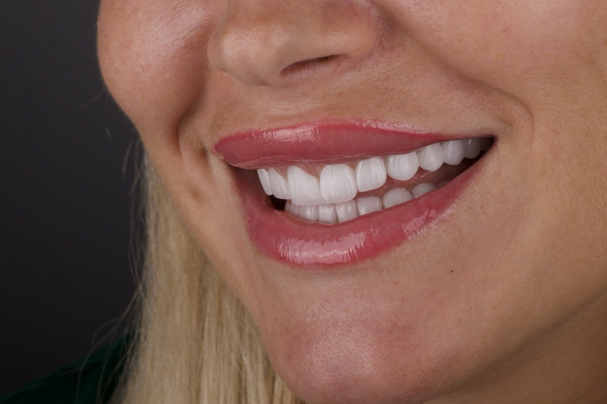 Smile Case 10 image 4