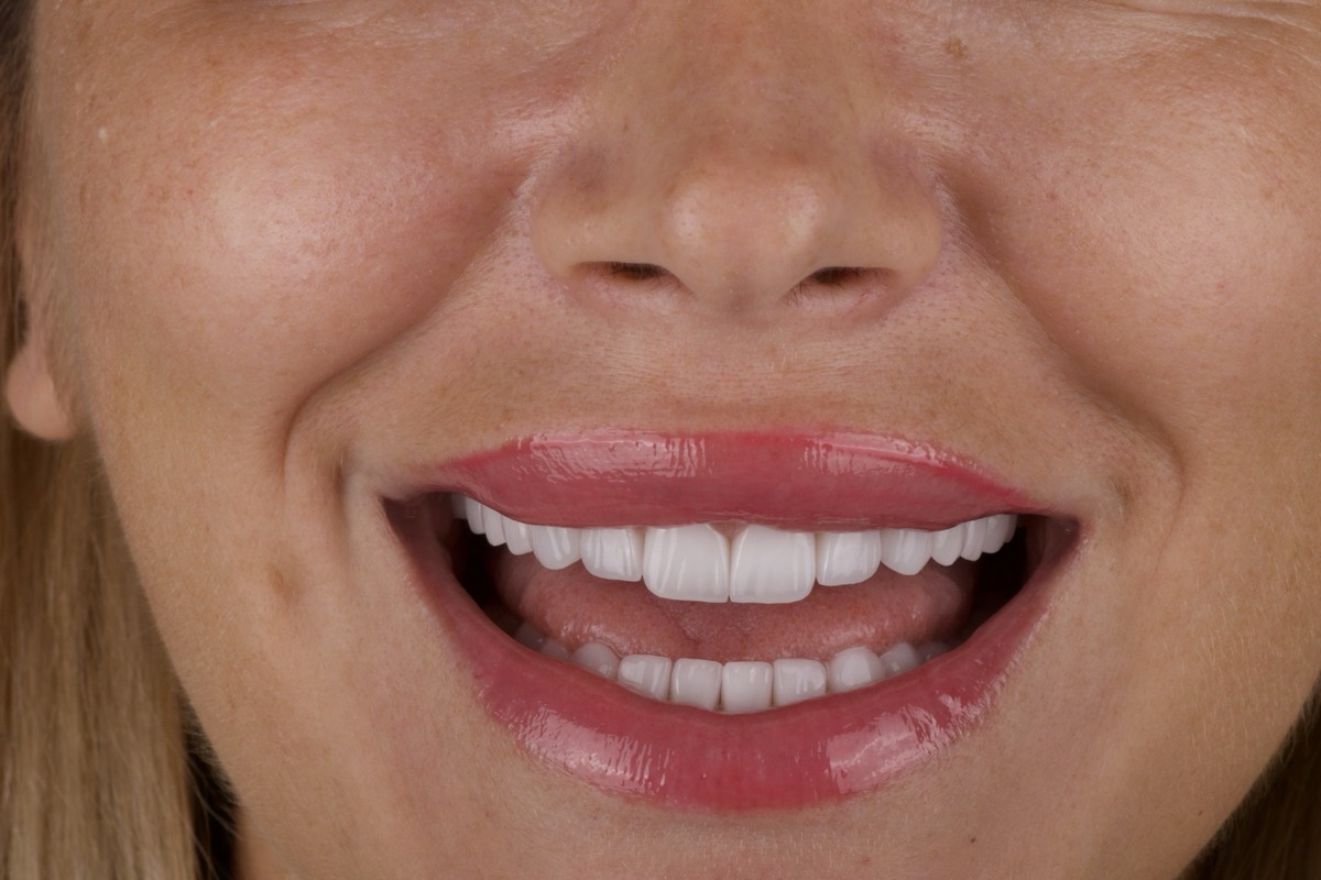 Smile Case 10 image 8