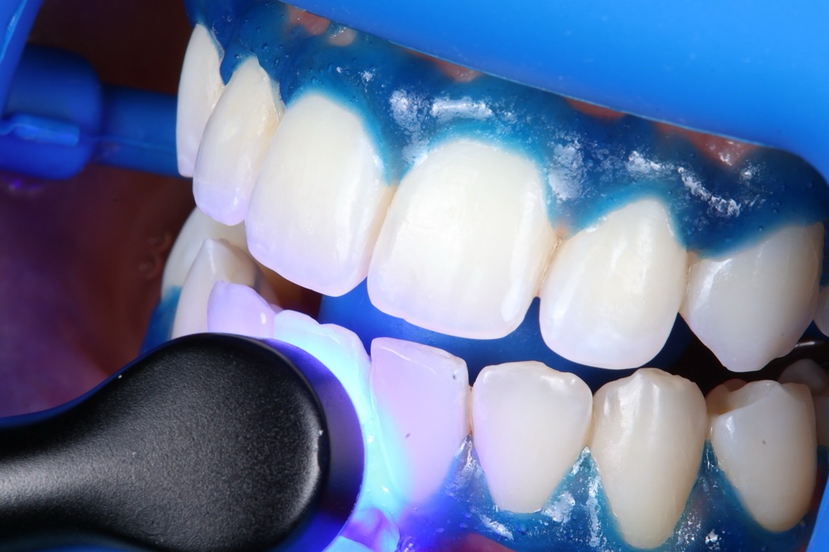 Smile Case 2 image 11
