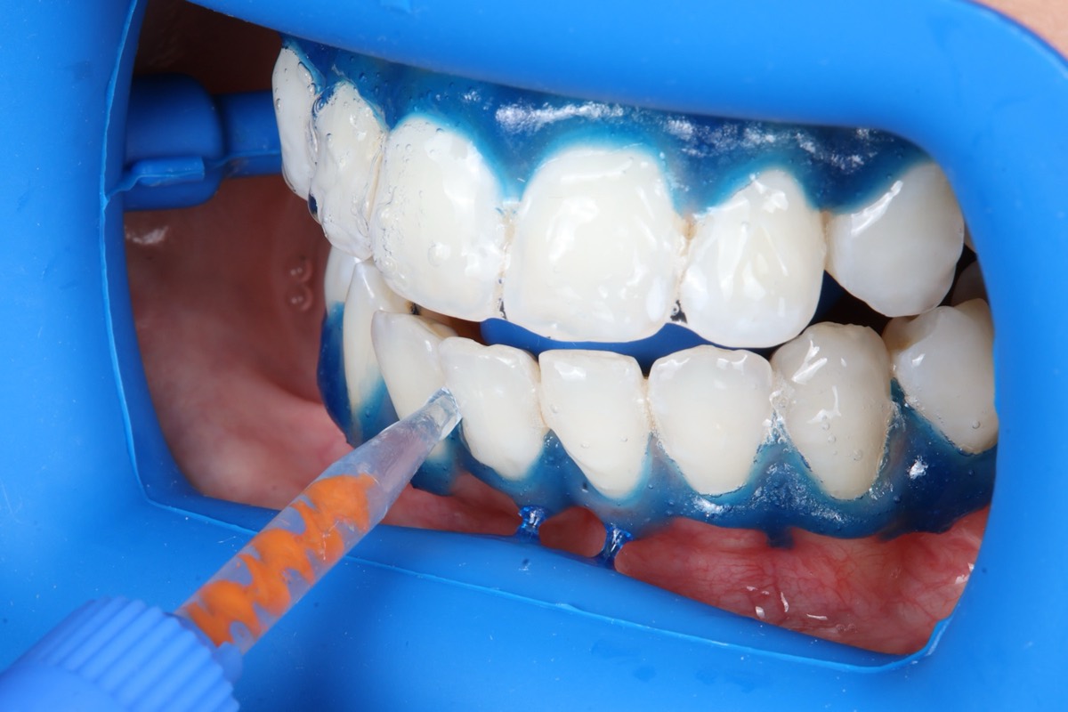 Smile Case 2 image 18