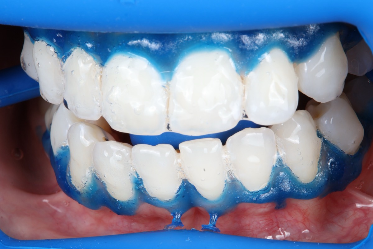 Smile Case 2 image 21